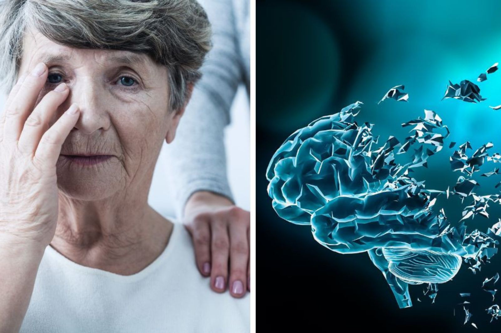 Bệnh Alzheimer liên quan đến rối loạn chuyển hóa thế nào?