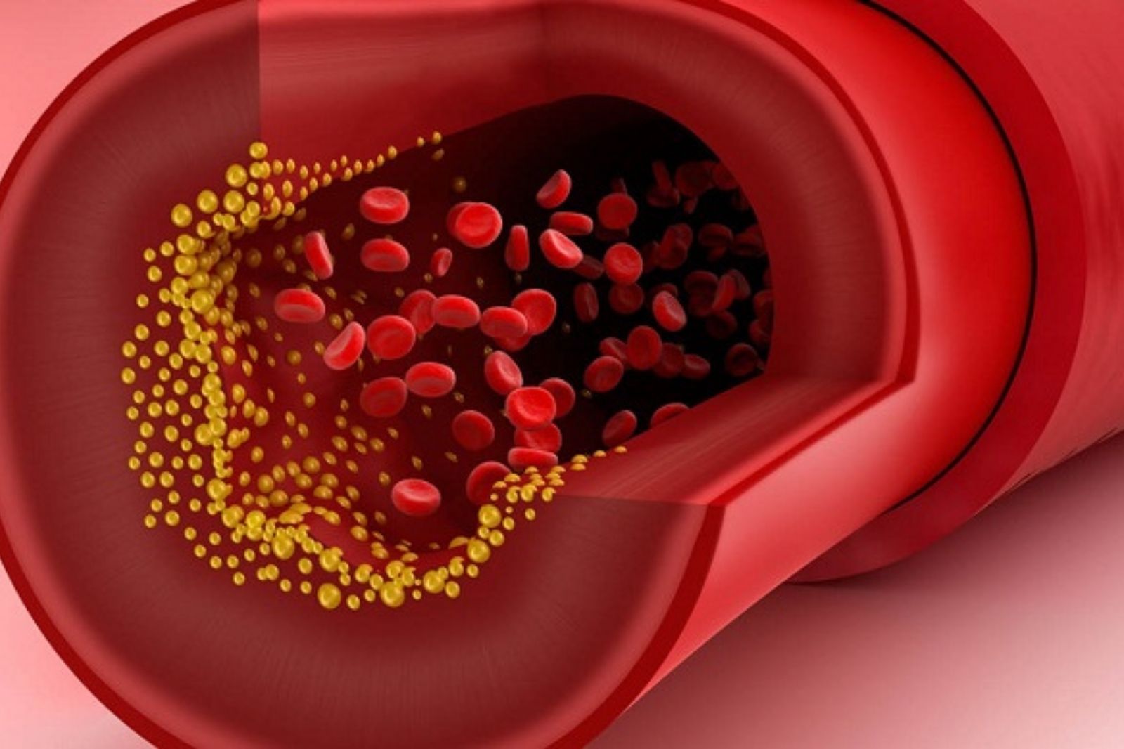 Cách giảm cholesterol xấu cho người trung niên