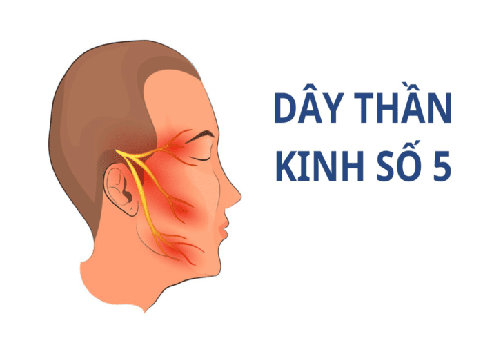 Đau dây thần kinh số 5: Cơn đau vô hình nhưng ám ảnh